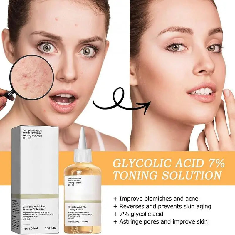Glycolic Acid 7% Face Toner – Exfoliate & Brighten